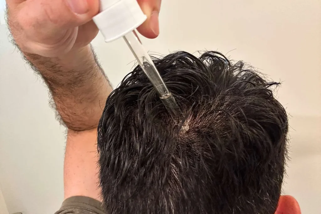 Copper Peptides vs. Minoxidil: Which Hair Loss Treatment is Right for You? 4 hlt the ordinary multi peptide serum for hair density 16 b2667bd0bf8646d89b8a670fe917382c